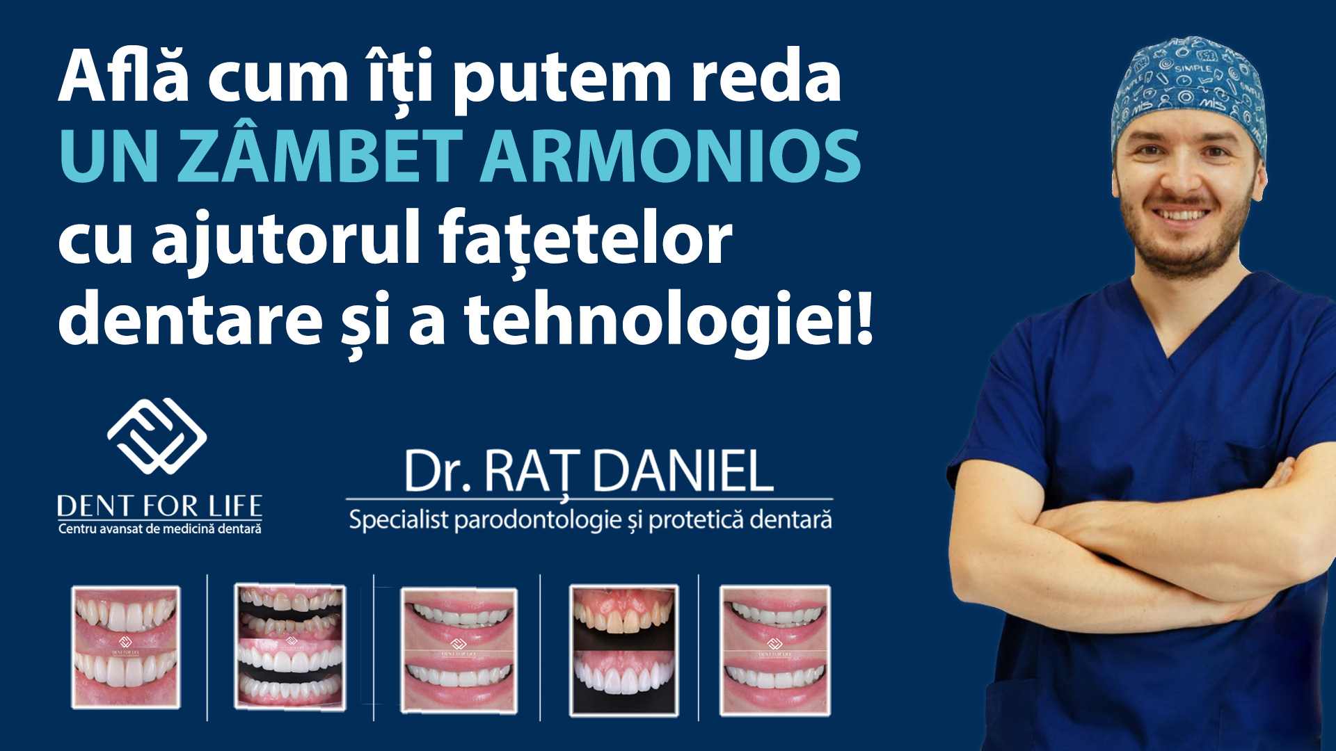 Simulare fațete dentare Dent For Life
