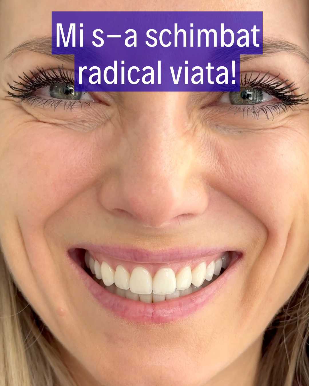 Testimonial video pacient Dent For Life